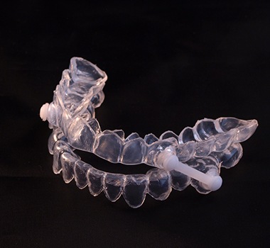 oral appliance for sleep apnea 