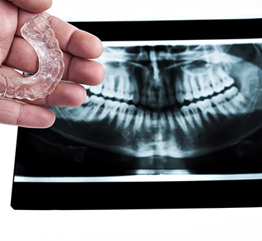 a dental X-ray in the background of a dentist holding a grinding guard