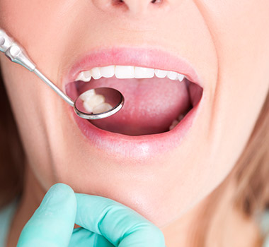 Closeup of patient receiving dental exam