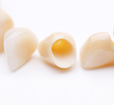 Tooth-colored dental crowns prior to placement