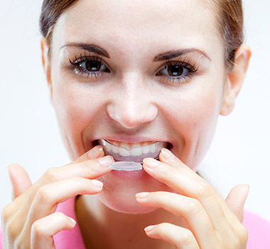 Woman using at-home teeth whitening kit