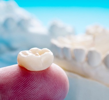 closeup of dental crowns in Landrum   