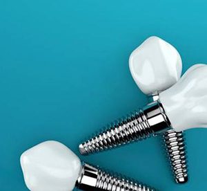 three dental implant posts with crowns