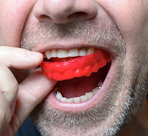 close-up of a man putting a red mouthguard into his mouth 