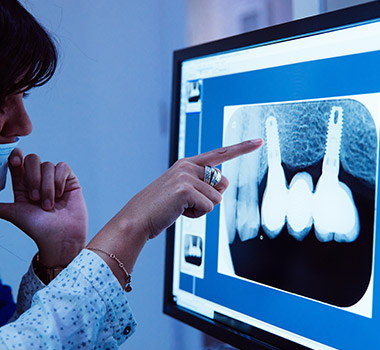 Dentist looking at digital dental x-rays