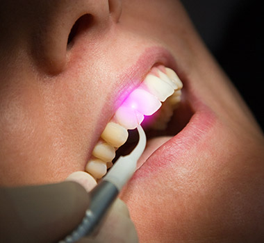 Patient receiving soft tissue laser treatment