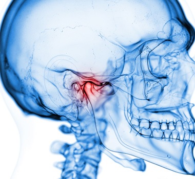 Illustration of skull with TMJ highlighted