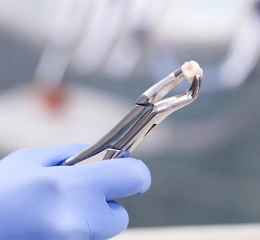 A dentist holding an extracted tooth.