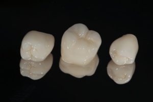 dental crowns near Tryon